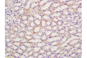 Formalin-fixed and paraffin embedded mouse kidney labeled with Anti-PTGER1 Polyclonal Antibody, Unconjugated (ABIN872820) at 1:200 followed by conjugation to the secondary antibody and DAB staining
