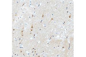 IHC analysis of PKC Epsilon/PRKCE using anti-PKC Epsilon/PRKCE antibody (ABIN3043908). (PKC epsilon anticorps  (AA 53-236))