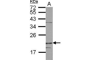 Western Blotting (WB) image for anti-Density-Regulated Protein (DENR) (AA 1-198) antibody (ABIN1501885) (Density Regulated Protein anticorps  (AA 1-198))