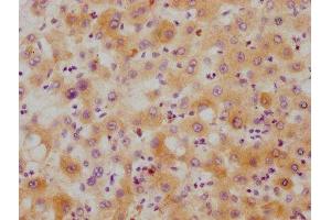 IHC image of ABIN7127534 diluted at 1:215 and staining in paraffin-embedded human liver tissue performed on a Leica BondTM system. (Recombinant Hepcidin anticorps)
