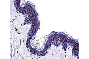 Tyrosinase antibody immunohistochemistry analysis in formalin fixed and paraffin embedded human skin tissue.