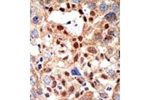 Image no. 2 for anti-Promyelocytic Leukemia (PML) (Sumoylation Site) antibody (ABIN357734) (PML anticorps  (Sumoylation Site))