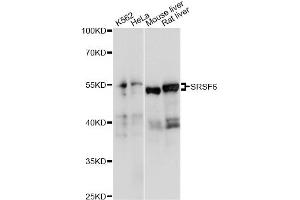 Western blot analysis of extracts of various cell lines, using SRSF6 antibody (ABIN6293560) at 1:1000 dilution. (SFRS6 anticorps)