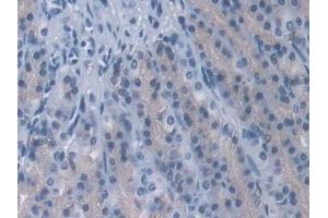 Detection of PPP2R4 in Rat Stomach Tissue using Polyclonal Antibody to Protein Phosphatase 2A Activator, Regulatory Subunit 4 (PPP2R4)