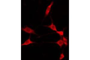 ABIN6274810 staining 293 by IF/ICC. (ADAM32 anticorps  (C-Term))