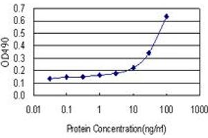 S100A8 (Human) Matched Antibody Pair