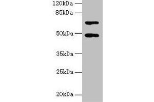 Western blot All lanes: HDAC3 antibody at 2 μg/mL + Hela whole cell lysate Secondary Goat polyclonal to rabbit IgG at 1/10000 dilution Predicted band size: 49, 50 kDa Observed band size: 49 kDa