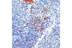 Immunohistochemistry of paraffin-embedded mouse spleen using S100 antibody (ABIN7270129) at dilution of 1:200 (40x lens).