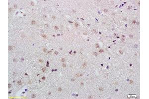 Formalin-fixed and paraffin embedded rat brain tissue labeled with Anti-KDM5B/PLU1/Jarid1B Polyclonal Antibody, Unconjugated  at 1:200 followed by conjugation to the secondary antibody and DAB staining (KDM5B anticorps  (AA 65-165))