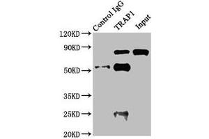 Immunoprecipitating TRAP1 in Jurkat whole cell lysate Lane 1: Rabbit control IgG instead of ABIN7154903 in Jurkat whole cell lysate. (TRAP1 anticorps  (AA 60-308))