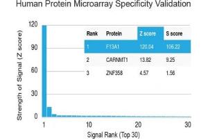 Analysis of HuProt(TM) microarray containing more than 19,000 full-length human proteins using Factor XIIIa antibody (clone F13A1/1448). (F13A1 anticorps  (AA 46-181))