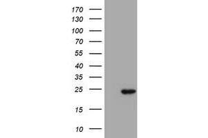 Western Blotting (WB) image for anti-Proteasome (Prosome, Macropain) Subunit, beta Type, 9 (Large Multifunctional Peptidase 2) (PSMB9) (AA 21-219) antibody (ABIN1491192) (PSMB9 anticorps  (AA 21-219))