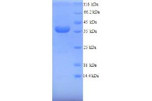 SDS-PAGE (SDS) image for Arginase, Liver (ARG1) (AA 1-323), (full length) protein (His tag) (ABIN5714380)