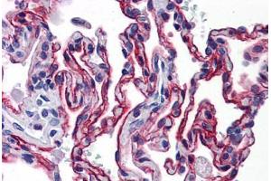 Human Lung: Formalin-Fixed, Paraffin-Embedded (FFPE)