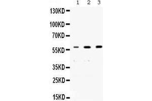 Western blot analysis of nmt55/p54nrb expression in rat brain extract (lane 1), human placenta extract (lane 2) and PANC whole cell lysates (lane 3). (NONO anticorps  (N-Term))