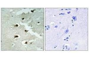 Immunohistochemistry analysis of paraffin-embedded human brain tissue using CDCA4 antibody. (CDCA4 anticorps)