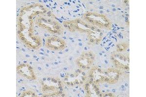 Immunohistochemistry of paraffin-embedded Rat kidney using HPS1 Polyclonal Antibody at dilution of 1:100 (40x lens). (HPS1 anticorps)