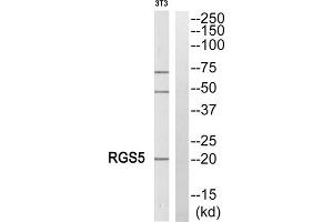Western blot analysis of extracts from NIH/3T3 cells, using RGS5 antibody. (RGS5 anticorps  (Internal Region))