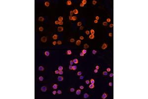 Immunofluorescence analysis of K-562 cells using CLIC1 Rabbit pAb (ABIN6128983, ABIN6138719, ABIN6138721 and ABIN6217770) at dilution of 1:150 (40x lens).