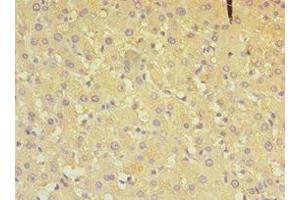 Immunohistochemistry of paraffin-embedded human liver tissue using ABIN7149648 at dilution of 1:100 (ALDH4A1 anticorps  (AA 354-563))