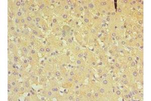 Immunohistochemistry of paraffin-embedded human liver tissue using ABIN7149648 at dilution of 1:100