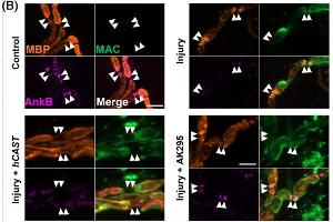 Nerve-muscle preparations from Glial or hCAST x Glial mice were treated acutely ex vivo with anti-GM1 Ab alone (Control) or with a source of complement (Injury) in the presence or absence of exogenous calpain inhibitor AK295. (ANK2 anticorps  (AA 203-496))