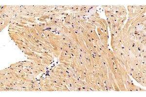 Immunohistochemistry analysis of paraffin-embedded mouse heart using,Nebulette (ABIN7074788) at dilution of 1: 1000 (Nebulette anticorps)