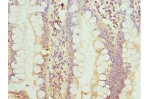 Immunohistochemistry of paraffin-embedded human small intestine tissue using ABIN7172749 at dilution of 1:100 (Protein C8orf4 (TCIM) (AA 1-106) anticorps)