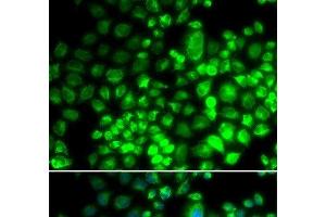 Immunofluorescence analysis of HeLa cells using ST6GAL1 Polyclonal Antibody (ST6GAL1 anticorps)