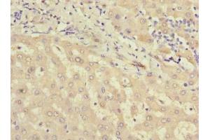 Immunohistochemistry of paraffin-embedded human liver tissue using ABIN7159418 at dilution of 1:100