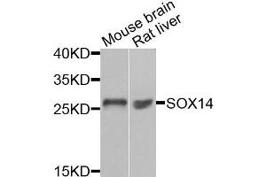 Western blot analysis of extracts of mouse brain and rat liver cells, using SOX14 antibody. (SOX14 anticorps)