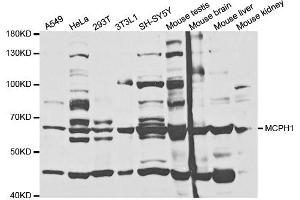 Western Blotting (WB) image for anti-Microcephalin 1 (MCPH1) antibody (ABIN1876660) (MCPH1 anticorps)