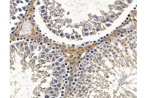 ABIN7096815 and ABIN7100881 at 1/100 staining rat testis tissue by IHC-P.
