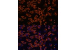 Immunofluorescence analysis of C6 cells using PRX antibody (ABIN7269215) at dilution of 1:100.