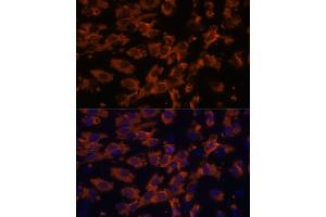 Immunofluorescence analysis of C6 cells using PRX antibody (ABIN7269215) at dilution of 1:100. (Periaxin anticorps  (AA 1250-1350))