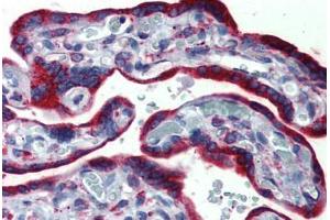 Human, Placenta: Formalin-Fixed Paraffin-Embedded (FFPE) (ERP44 anticorps  (C-Term))