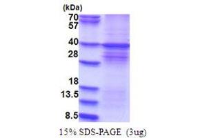 SDS-PAGE (SDS) image for Dual-Specificity tyrosine-(Y)-phosphorylation Regulated Kinase 1A (DYRK1A) (AA 159-479) protein (His tag) (ABIN5853755)