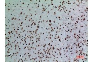 Immunohistochemistry (IHC) analysis of paraffin-embedded Mouse Brain, antibody was diluted at 1:100.
