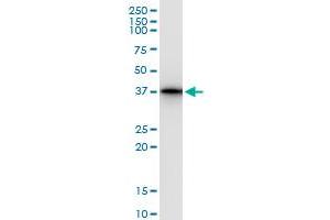 anti-Leucine Zipper Transcription Factor-Like 1 (LZTFL1) (AA 1-299) antibody