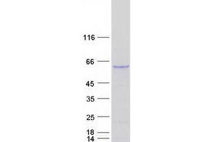Validation with Western Blot