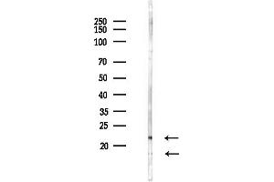 anti-Ribosomal Protein S11 (RPS11) (C-Term) antibody