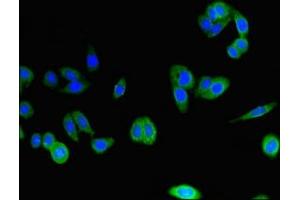 Immunofluorescent analysis of HepG2 cells using ABIN7146589 at dilution of 1:100 and Alexa Fluor 488-congugated AffiniPure Goat Anti-Rabbit IgG(H+L)