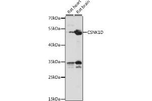 Western blot analysis of extracts of various cell lines, using CSNK1D antibody (ABIN7266100) at 1:1000 dilution. (Casein Kinase 1 delta anticorps  (AA 250-350))