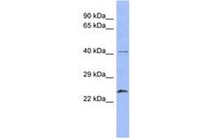 Image no. 1 for anti-RAB5B, Member RAS Oncogene Family (RAB5B) (N-Term) antibody (ABIN6744088) (RAB5B anticorps  (N-Term))
