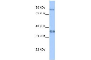 WB Suggested Anti-ZFP64 Antibody Titration:  0. (ZFP64 anticorps  (Middle Region))