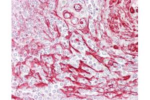 Anti-TAGLN / SM22 antibody IHC of human spleen.