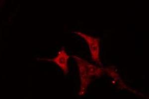 ABIN6274992 staining NIH-3T3 cells by IF/ICC. (Cep76 anticorps  (Internal Region))