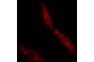 ABIN6274978 staining  Hela cells by IF/ICC. (CNOT4 anticorps  (N-Term))