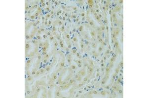 Immunohistochemistry of paraffin-embedded mouse kidney using RCC1 antibody (ABIN5973761) at dilution of 1/100 (40x lens). (RCC1 anticorps)