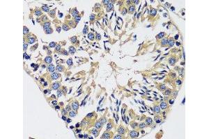 Immunohistochemistry of paraffin-embedded Mouse testis using CAMLG Polyclonal Antibody at dilution of 1:100 (40x lens).